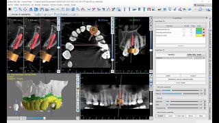 CERIK3D - VIVO Curso Guia Quirurgicas 3D en Blue Sky Bio Plan - Tutorial