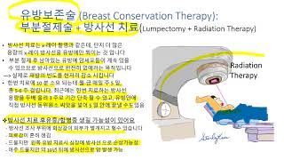 유방암 환자를 위한 강의: 최신치료법