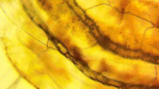 mosquito larvae - culex.wmv