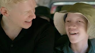 Born Too White - Being Albino in East Africa | Medical Documentary | Reel Truth. Science