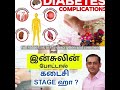 Diabetes: insulinஇன்சுலின் போட்டால் கடைசி Stage ஹா ? Dr.Sivaprakash