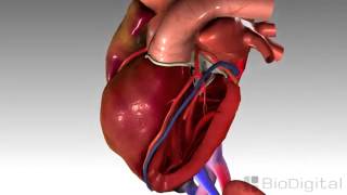 3D Medical Animation   Congestive Heart Failure