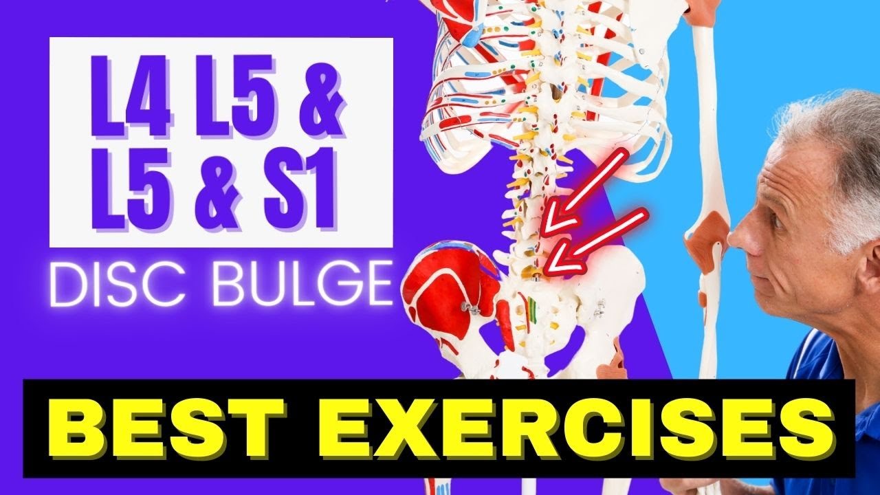 L4 L5 & L5 S1 Disc Bulge, Best Exercises Rehab For Relief - YouTube