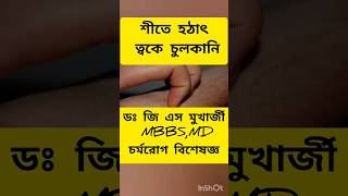 শীতে হঠাৎ ত্বকে চুলকানি #allergy #itching #urticaria