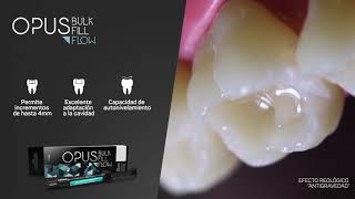 Composite fotocurable Opus Bulk Fill FGM