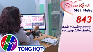 Khối u buồng trứng có nguy hiểm không? | Sống khỏe mỗi ngày - Kỳ 843