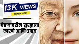 चेहऱ्यावरील सुरकुत्या -कारणे आणि उपाय (Wrinkles on the face - Causes and remedies)