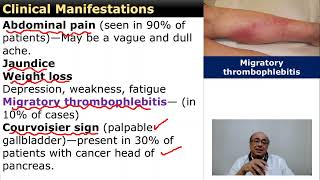 Cancer of the Pancreas