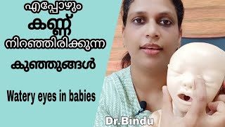 #95 Blocked tear duct/കുഞ്ഞുങ്ങളുടെ കണ്ണിൽ നിന്നും പീള കെട്ടിയാൽ വെള്ളം വന്നാൽ എന്തു ചെയ്യണം?