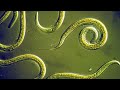 Phylum Nematoda Part 1: Introduction to the Roundworms