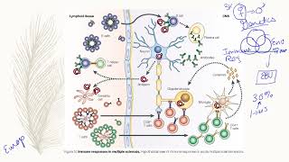 Multiple Sclerosis