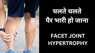 चलते चलते पैर भारी हो जाना (PART 2) #slipdisc #backpain #facetjointarthritis #claudication #sciatica