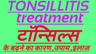 टॉन्सिलाइटिस होता क्यों है,कारण क्या,उपाय क्या है,इलाज कैसे करें,Treatment of Tonsillitis,