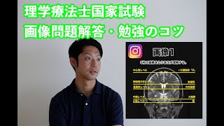 【10分で理解】理学療法士国家試験画像問題解答・勉強のコツ