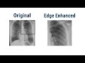 Image Filters (Smoothing Filter, Edge Enhancement Filters)