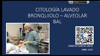 Citología del Lavado Bronquiolo Alveolar – BAL