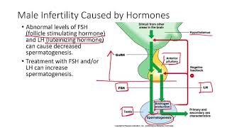 Infertility