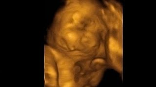 4D Ultrasound of Baby at 29 Weeks - itsJudysLife