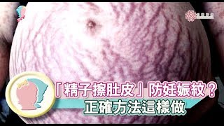 【妊娠紋】妊娠紋去去走！紅紋、白紋如何消除？｜陳志軒醫師｜禾馨形體美學｜寶貝幫X馨講堂 47