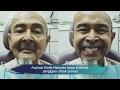 DIAN: Aspirasi Smile Malaysia tawar khidmat pergigian untuk semua