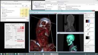 Interactive Volume Ray Casting on GPU