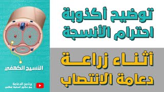 توضيح أكذوبة احترام الأنسجة أثناء زراعة دعامة الانتصاب | برنامج الدعامة الحلقة  21