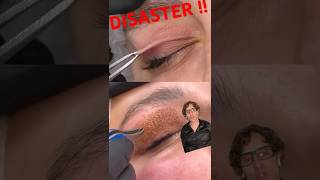 DISASTER FIBROBLAST PLASMAPEN EYE TREATMENT!!