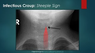 Steeple Sign