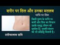 नाभि पर तिल का मतलब meaning of moles on navel