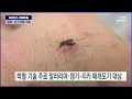 pick사이언스 과학계가 공들인 모기 박멸 기술 .. 부작용은 없나