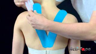 Acti-Tape - Upper Back - Posture Correction