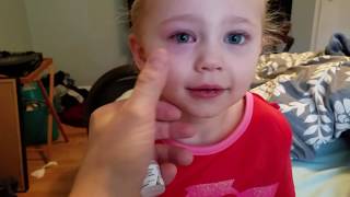 The best way to do eyedrops on a child!!!