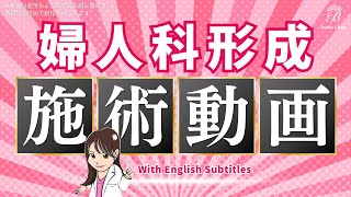 【婦人科形成】女性器の手術映像を大公開！医師が解説！