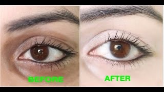 How to Remove Dark Circles Naturally in 3 Days (100% Results)