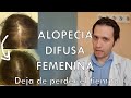 Alopecia difusa femenina: mejor tratamiento (dermatologo te lo explica)