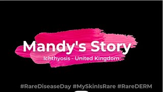 Living with ichthyosis: Mandy's Story