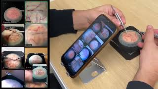 Mycro | Microvascular Anastomoses and Microsutures Simulator with Free Hands-on Lessons included