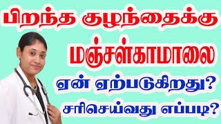 பிறந்த குழந்தைக்கு மஞ்சள்காமாலை ஏன் ஏற்படுகிறது சரி  செய்வது எப்படி Physiological Jaundice in Tamil