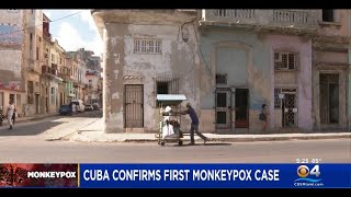 Cuba Confirms First Monkeypox Case