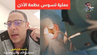 مرض تسوس عظام الأذن اعراضه وعلاجه | اهلا يا دكتور تسوس عظام الأذن استشارة طبية هاطمنك