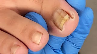 Pedicure Tutorial: Well Repaired Toenails, Efficient and Painless【Xue Yidao】