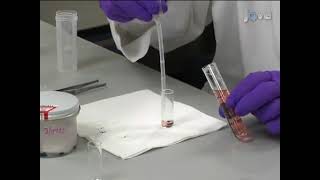 Preparation of Cell Blocks from Cytology Samples with a Predominance of Individually Scattered Cells