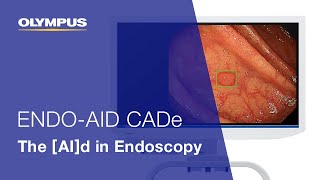 ENDO-AID CADe: The AId in Endoscopy | EVIS X1 | Gastroenterology | OLYMPUS