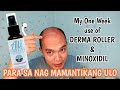 MY ONE WEEK USE OF DERMA ROLLER & MINOXIDIL | Para sa Nag Mamantikang Ulo | For Oily Hair