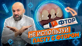 ФТОР УНИЧТОЖАЕТ ЗУБЫ.  НЕ используй эту зубную пасту! Зачем фтор добавляют в пасту?