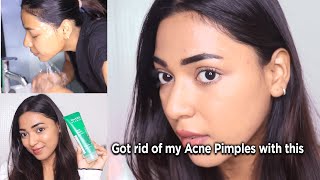 My Secret to Clear Skin: How I got rid of my Acnes/Pimples | Jovees Herbal Tea Tree Face Wash Review