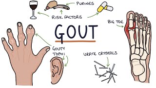 Gout: Visual Explanation for Students