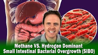 Methane VS. Hydrogen Dominant Small Intestinal Bacterial Overgrowth (SIBO)