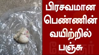 பிரசவமான பெண்ணின் வயிற்றில் பஞ்சு