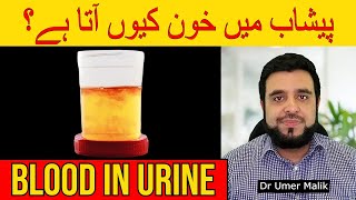 Blood In Urine Peshab Mein Khoon Ki Waja Pesab Karne Me Blood Aana